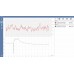 Pico USB TC-08 8-channel thermocouple data logger